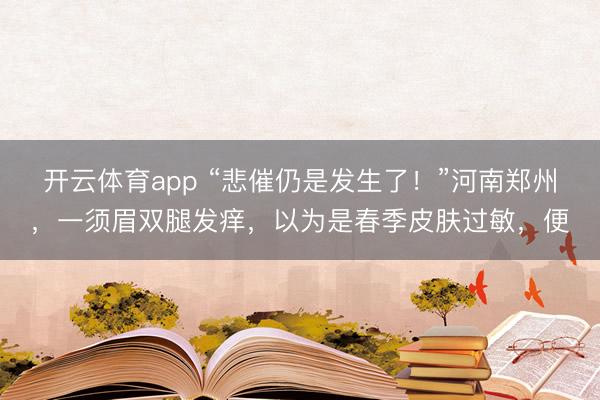 开云体育app “悲催仍是发生了！”河南郑州，一须眉双腿发痒，以为是春季皮肤过敏，便